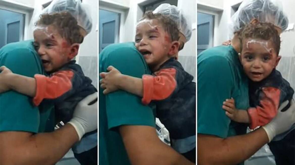 Συρία: Τραυματισμένο παιδί αρνείται να αποχωριστεί τον νοσοκόμο που το φρόντισε